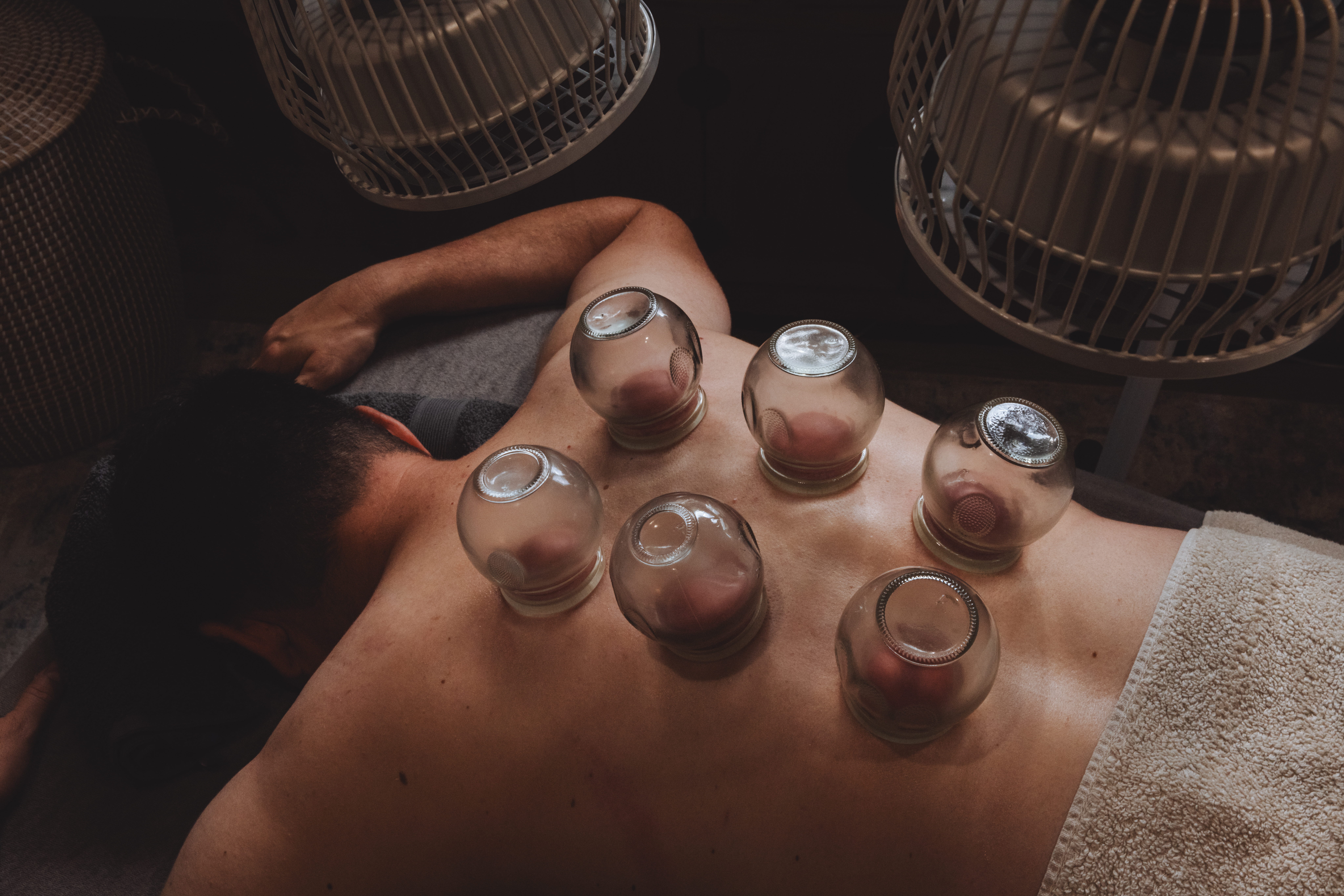 Chinese medicine cupping therapy